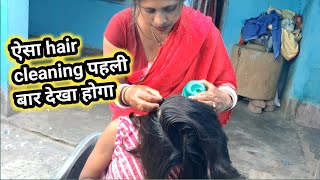 👉 Aisa Hair Cleaning Pehli Baar Dekha 😳 | Real ASMR Scalp Cleaning 💆‍♀️