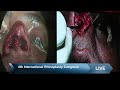 Jaipurdoorbeen hospital live stream