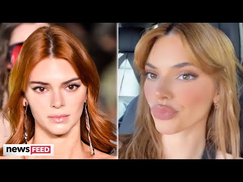Kendall Jenner Shows Off PUFFY Lips & The Internet Speculates About Fillers!