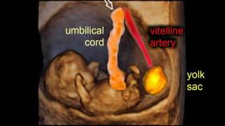 9 weeks of pregnancy: gestational sac and embryo - 3D scan