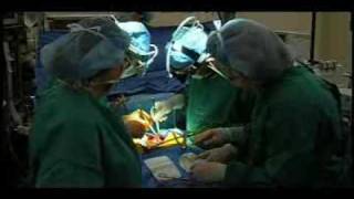 Mitral Valve Prolapse