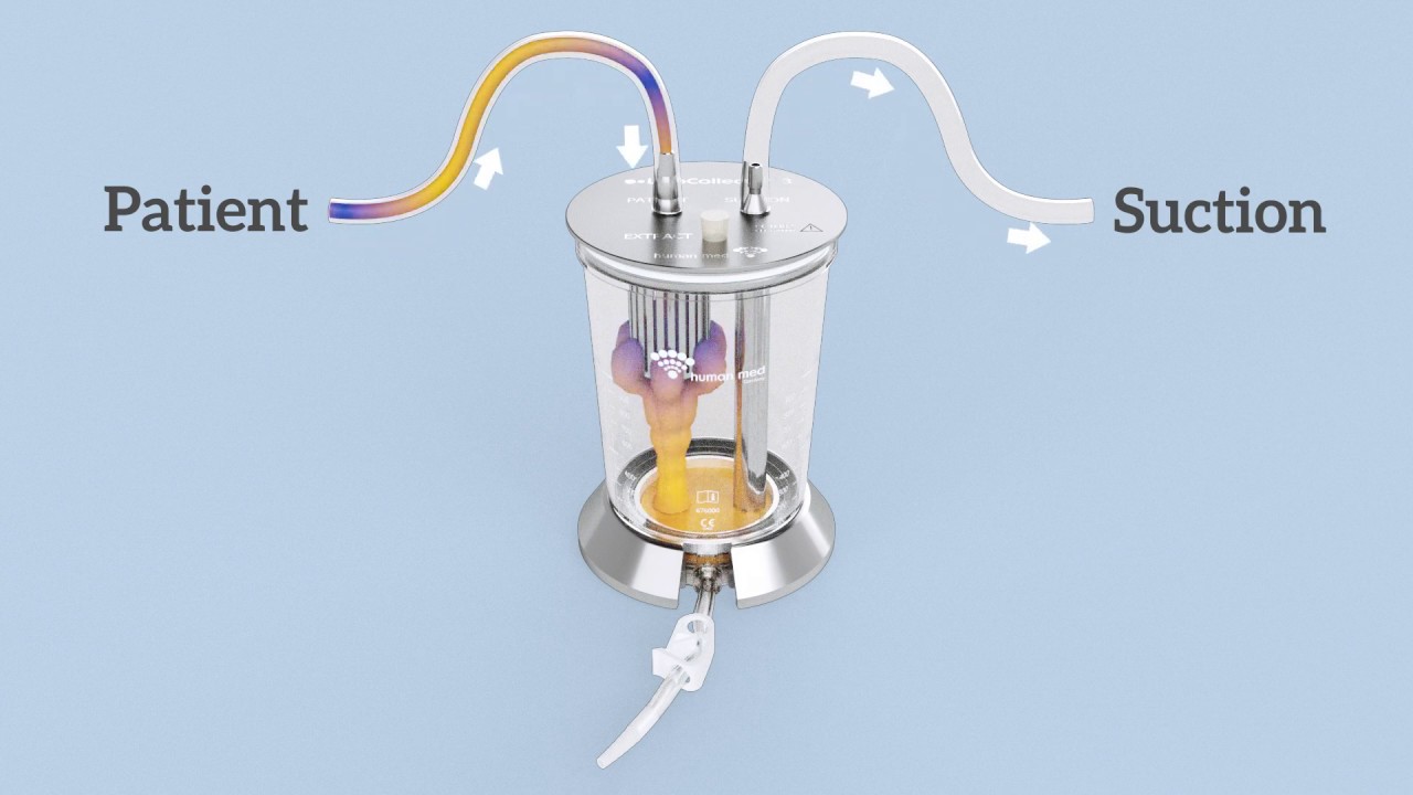 LipoCollector III (Human Med, Germany) animation - How it works