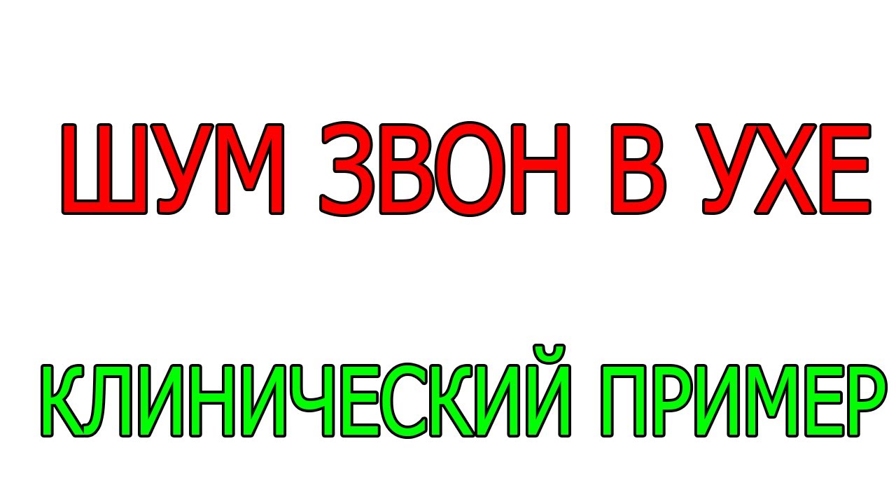 Тиннитус Шум звон свист в ушах голове, СПА ? Клинический пример Лечение ...