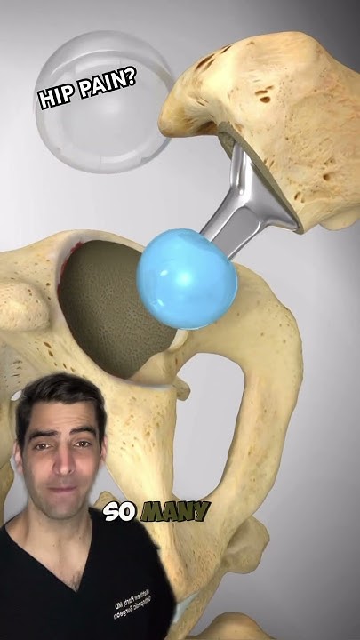 minimally-invasive-hip-replacement-youtube