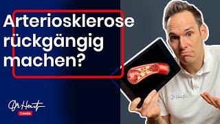 Arteriosklerose rückgängig machen (geht das wirklich?) | Dr. Heart