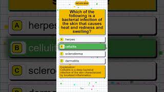 Kaplan NCLEX Questions and Leaked NCLEX Questions Reddit for Nursing Graduates 2026 Prep