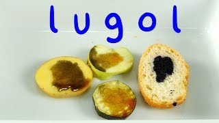 Lugol. Iodine Test. Starch Detection