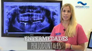 ¿Qué son las enfermedades periodontales?