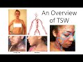 An Overview of TSW (Topical Steroid Withdrawal)