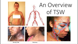 An Overview of TSW (Topical Steroid Withdrawal) screenshot 2