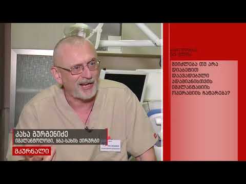 ყბა-სახის ქირურგი, იმპლანტოლოგი, პაროდონტოლოგი  კახა  გურგენიძე