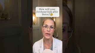 Forehead after Botox #botox #beauty #filler #skincare