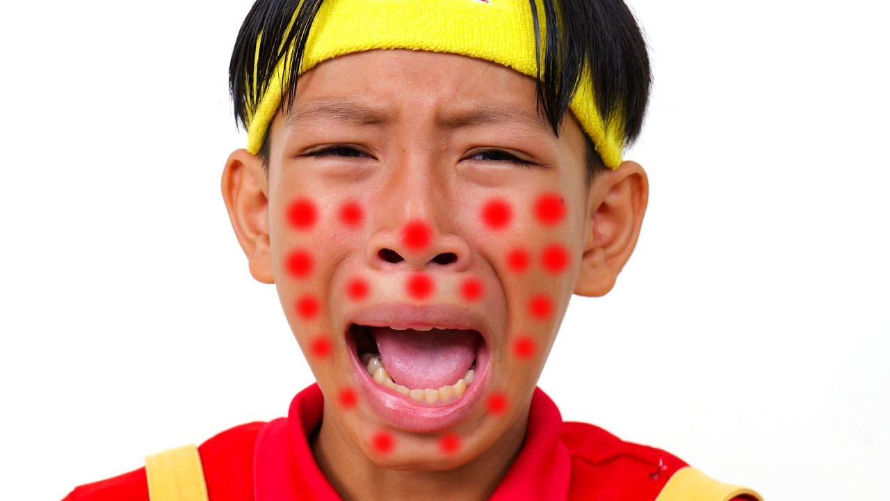 I'm So Itchy Song 5 | Nursery Rhymes & Children's Song