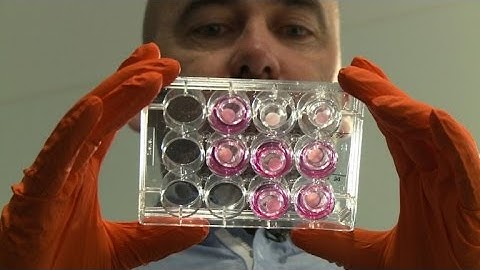 Bio-printing: the future of skin replacement?