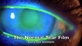 The normal tear film