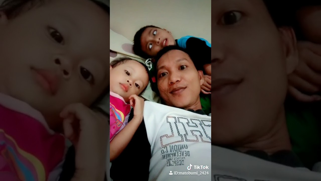 Tiktok Mata juling 