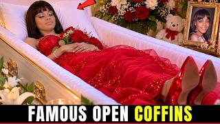 15 Celebrities You Didn’t Know Had Open-Casket Funerals | Disturbing Tragedies