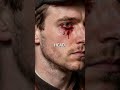 Man Survived 3-Foot Iron Rod Blasting Through His Skull