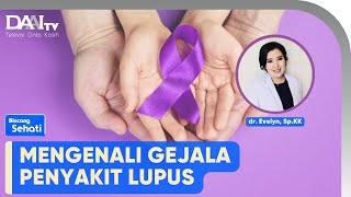 Lupus, Si Penyakit Seribu Wajah | Bincang Sehati