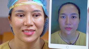 🎥🔴 CẮT MÍ MANI OPEN DEEP 5D KẾT HỢP MỞ GÓC MẮT ĐẸP NGOÀI MONG ĐỢI