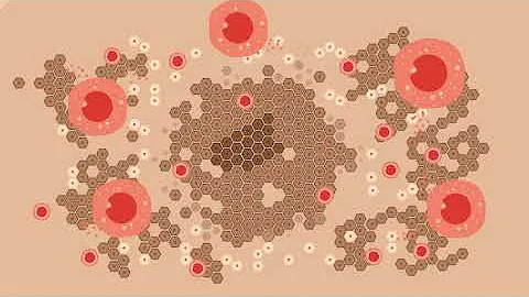 How melanoma 'deceives' the immune system, increasing resistance to immunotherapy
