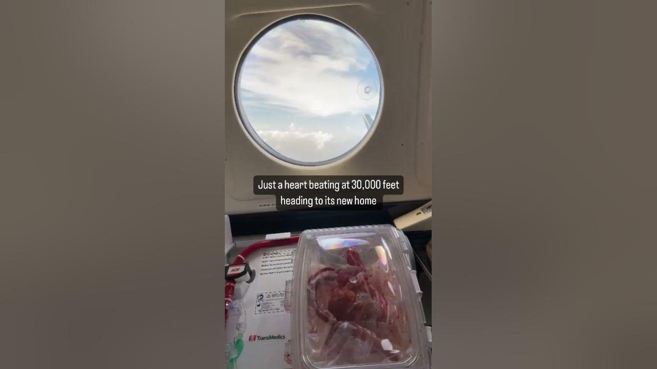 Warm perfused beating donor heart in transit for a transplant #cardiology