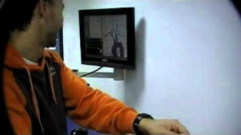 Patient specific modeling of the carotid arteries for simulation