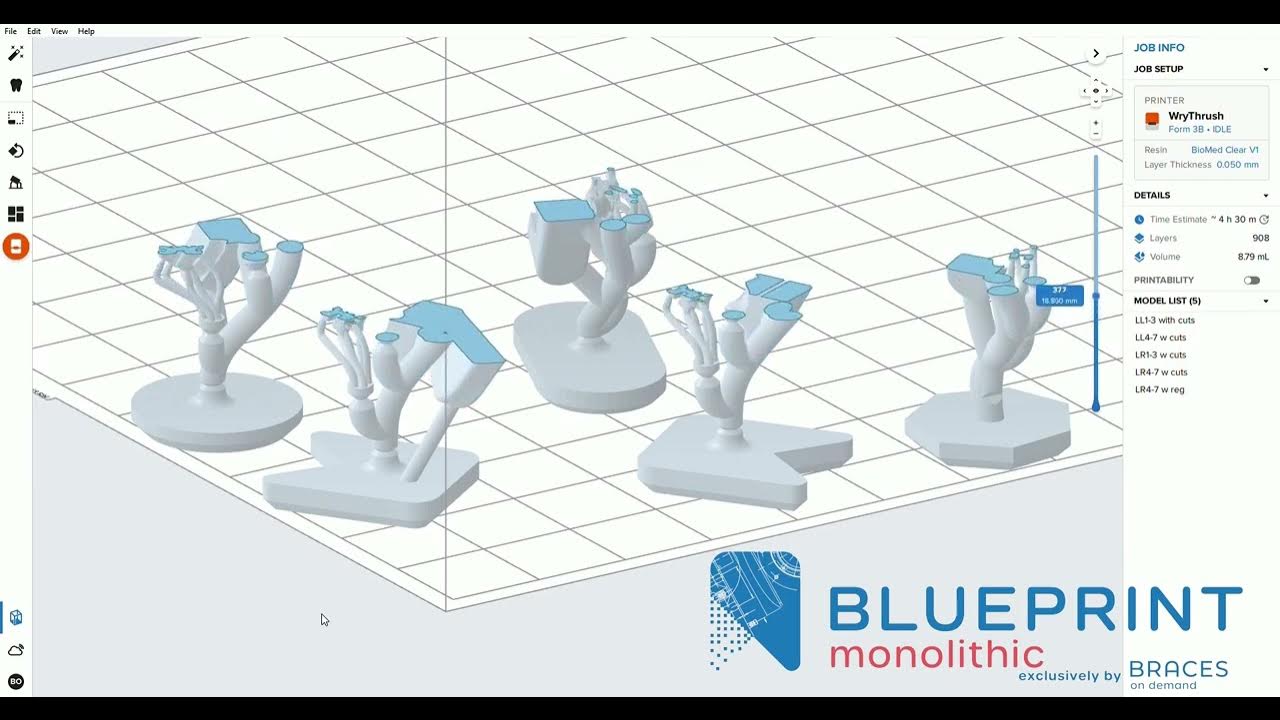 Braces On Demand Monolithic, 3D Printed YouTube