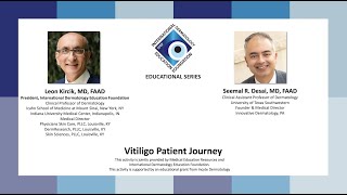 IDEF Educational Series Webinar  Vitiligo Patient Journey