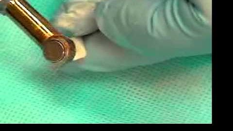 Video 01 Estimated Working length & Access