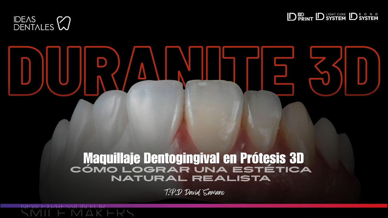 Maquillaje Dentogingival en Prótesis 3D ¿Cómo lograr una Estética Natural Realista? | ID NanoStain