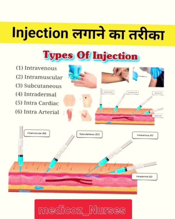 types of injection 💉 #nurse #hospital #youtubeshorts #internationallyeducatednurse #youtube #medical