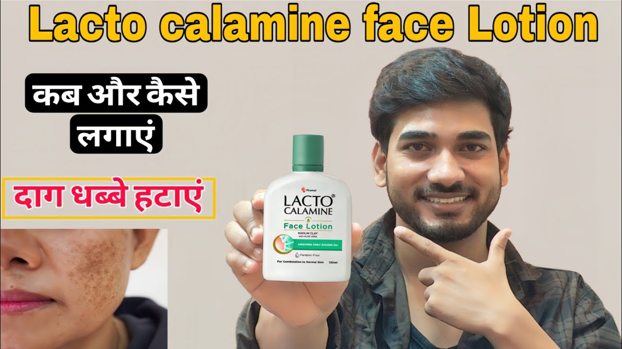 Lacto Calamine Face Lotion Honest Review | How to use lacto calamine lotion | लैक्टो कैलामाइन लोशन