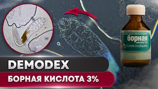 Борная Кислота 3% против клеща | Угревая Железница Demodex