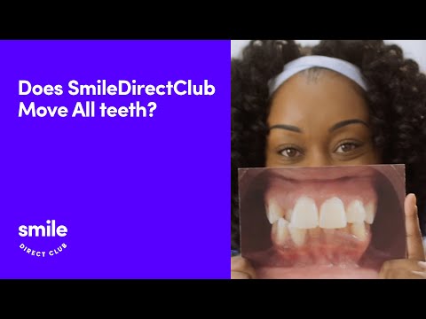 Does SmileDirectClub Move All Teeth? A Doctor Answers