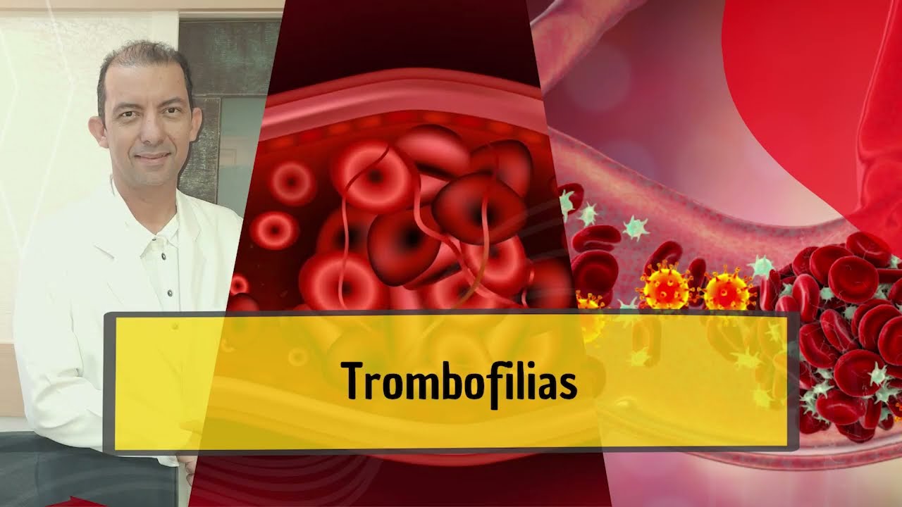 Trombofilias 