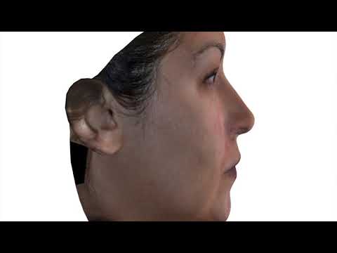 Computer morphing for