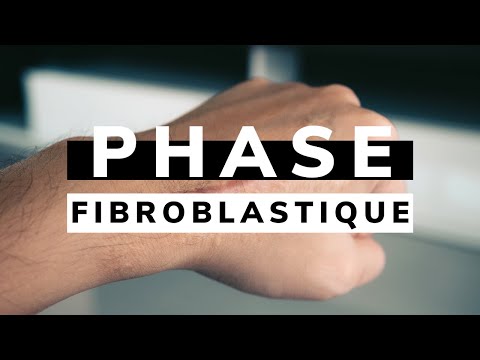 Vidéo: Qu'est-ce que la réparation fibroblastique ?