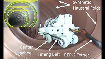 AMTL - Robotic Endoscopy Localization, Navigation and Haustral Fold Detection