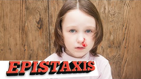 epistaxis|nose bleeding