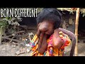 The Woman With No Face | BORN DIFFERENT