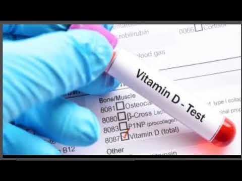 سعر تحليل فيتامين د في معامل المختبر وألفا والبرج 2023