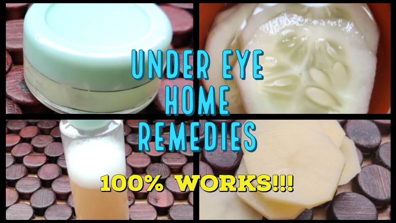Dark Circles Under Eyes Home Remedy in Telugu Get rid of Under Eyes