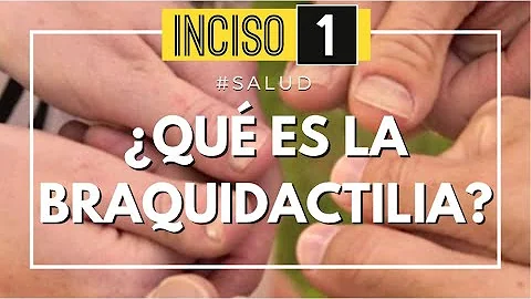 ¿Cómo se llama el dedo gordo raro?