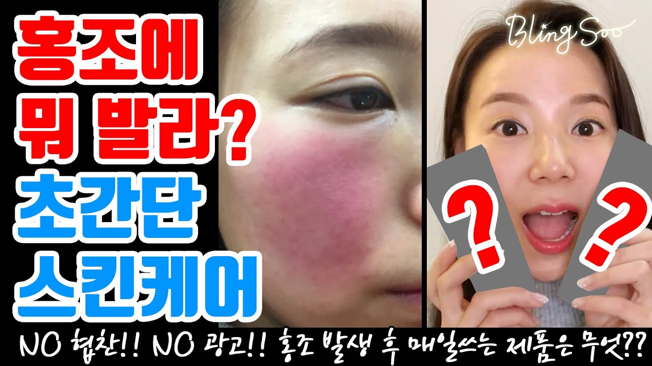 홍조에 뭐 발라? 초간단 스킨케어 이거면 끝! 홍조화장품 안면홍조치료 - YouTube