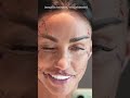 Katie Price Sports Tiny Black Leotard As She Shows Off Face Lift Results