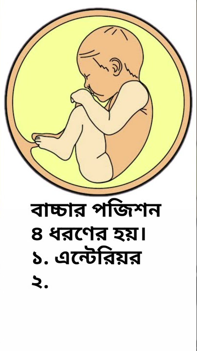 গর্ভে বাচ্চা যে পজিশন গুলোতে থাকে | Wobm baby #shorts