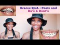 Braces Cost in South Africa // Prices from Different Orthodontists.