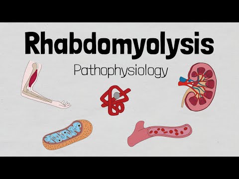 Rhabdomyolysis: Pathophysiology