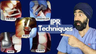 IPR: Ultimate Review Video of Different Techniques and Methods for GDPs